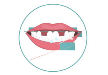 Brush Step 2 - Brush the Outer Surface in a Circular Motion