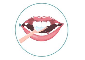 Brush Step 4 - Repeat for Inner Surface